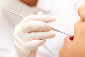 歯のメインテナンス