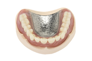 補綴治療(入れ歯)