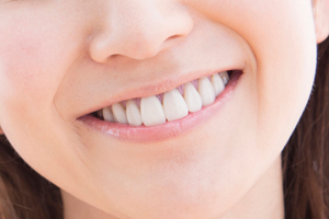 審美歯科・ホワイトニング